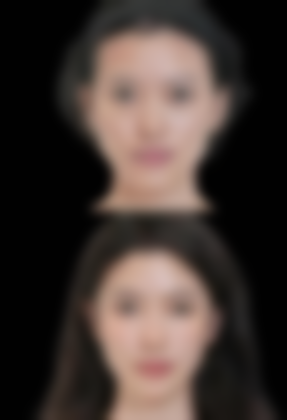 秦雷医生的医美项目价格情况