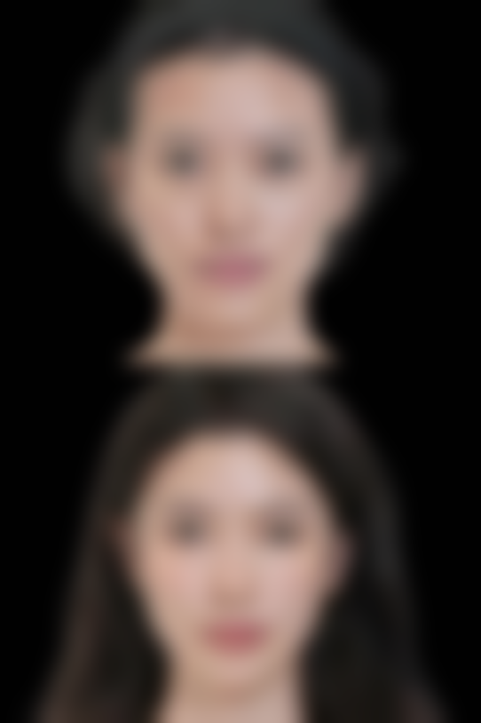 淄博张店千和整形医院求美者反馈