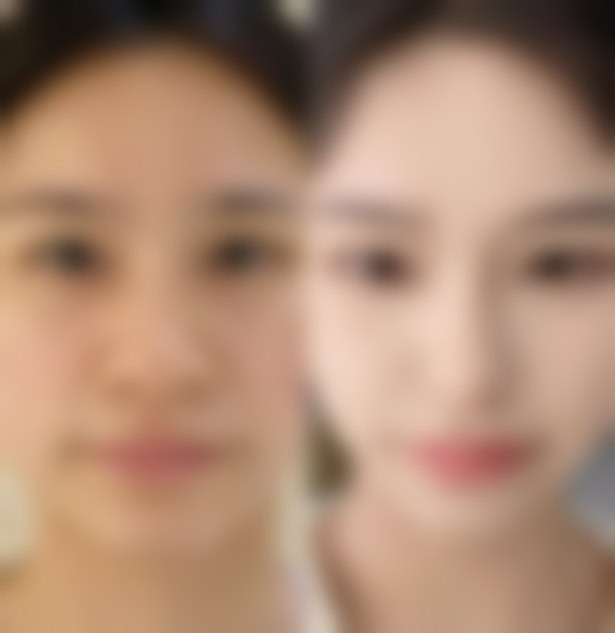 湘潭市非常好人民医院整形美容科怎么样特色项目及技术优势