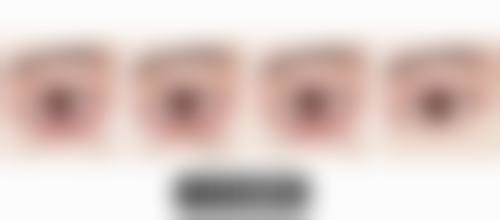 西安爱丁医疗美容门诊部怎么样求美者反馈