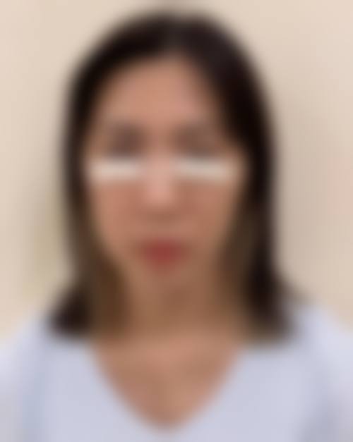 朱昭炜医生:为你定制专属美丽方案