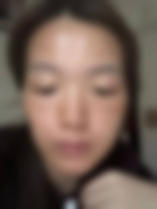 北京明会红整形医院求美者反馈