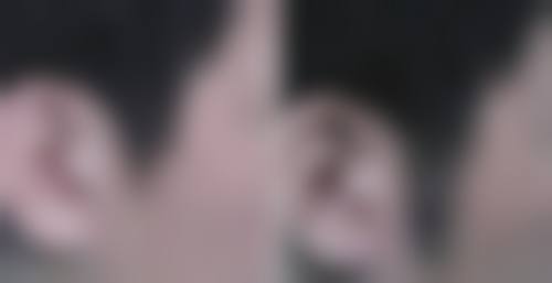 太原大麦微针植发诊所医生团队实力