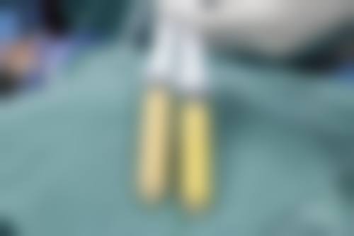 史迎军 医生的成功实例