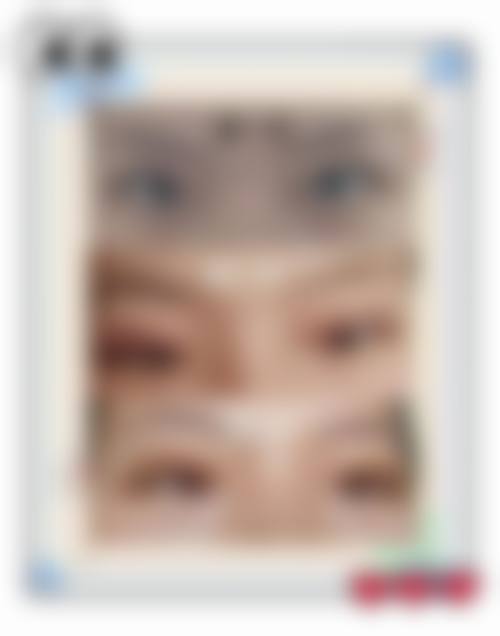 西安医学校附属医院整形美容科怎么样医生团队实力