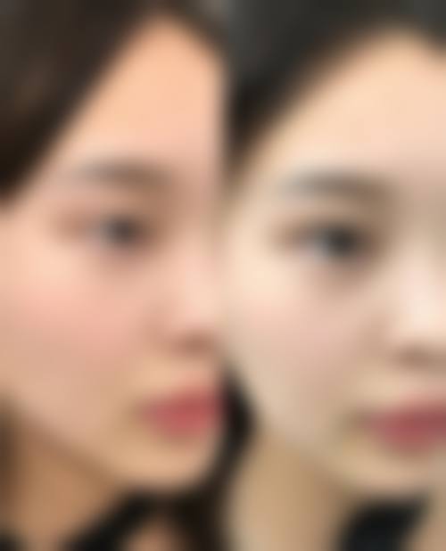 武汉硚口千和整形医院怎么样价格收费