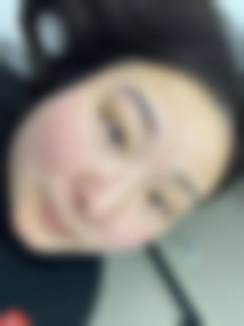 湖北孝感芯薇整形医院怎么样求美者反馈