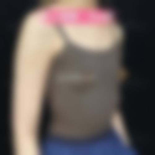 重庆欧黛尔医疗美容诊所求美者反馈