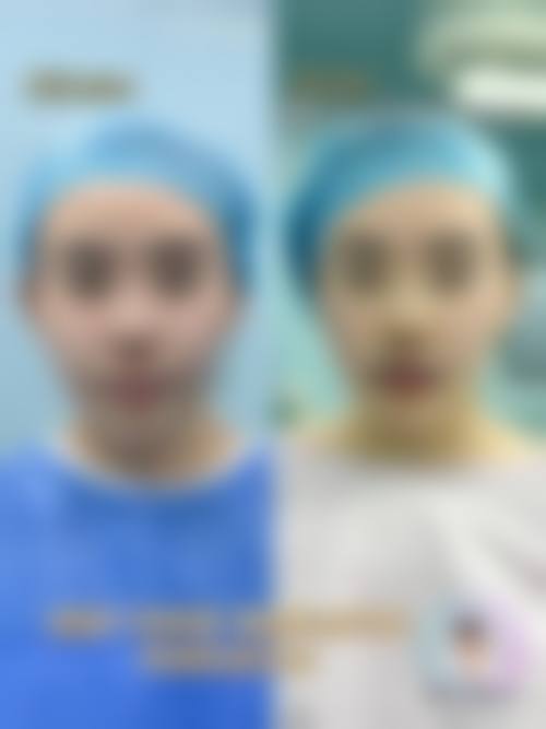 湖北孝感芯薇整形医院怎么样特色项目及技术优势