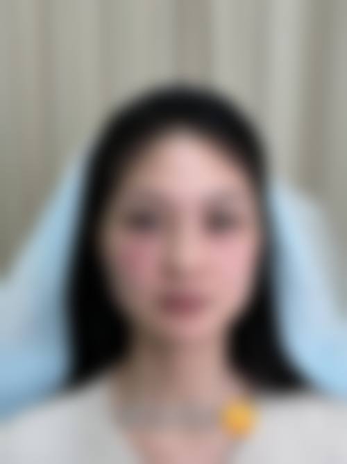 吉林金岩松整形医疗美容诊所怎么样求美者反馈