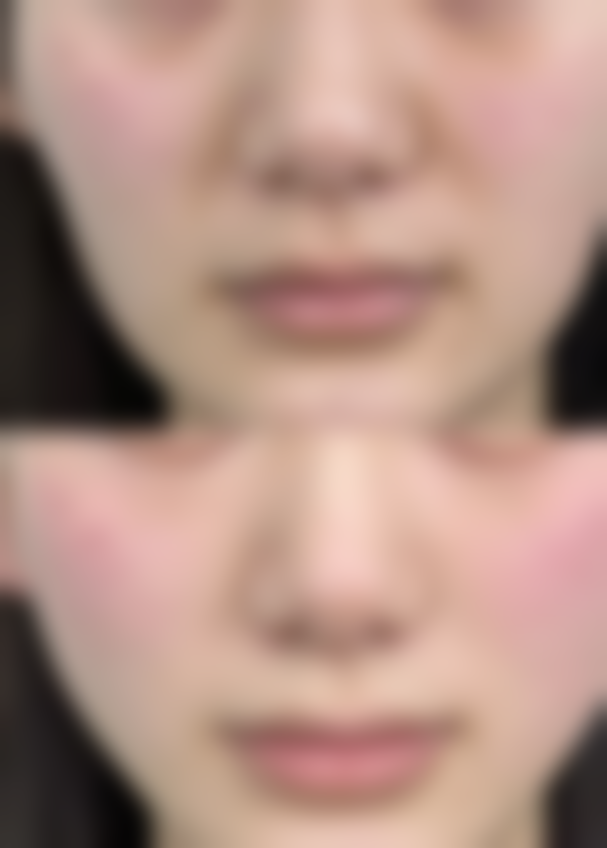 碧莲盛美学植发（宁波分院）医生团队实力