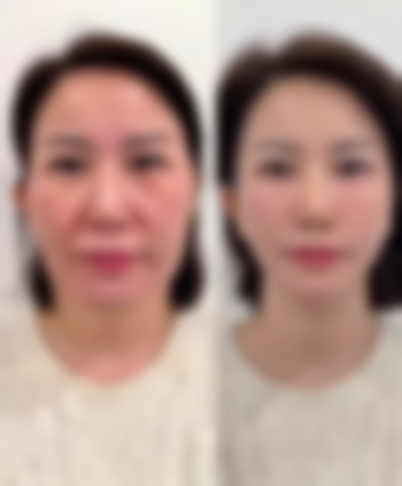 北京首玺医疗美容医院怎么样求美者反馈