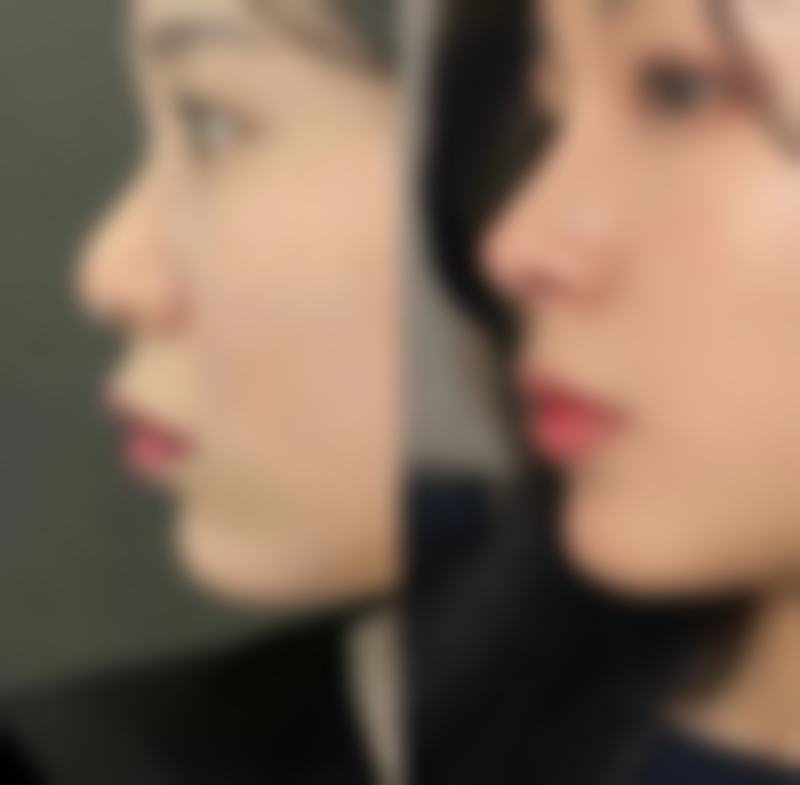 辽宁万佳整形医疗（大连）怎么样特色项目及技术优势