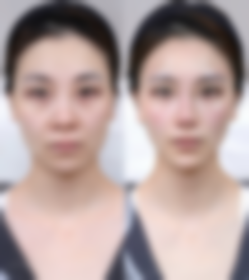 朴聖淏院长:良好的患者口碑