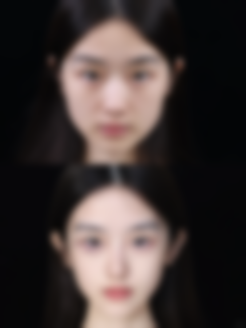 碧莲盛美学植发（宁波分院）简介概述