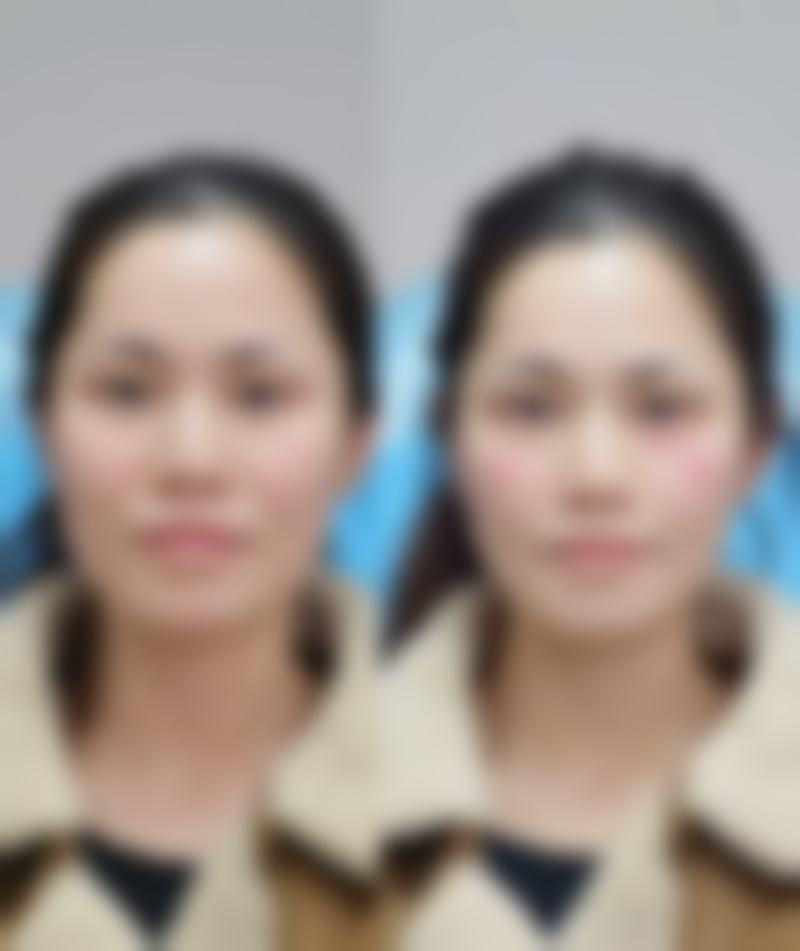 碧莲盛美学植发（宁波分院）基本信息