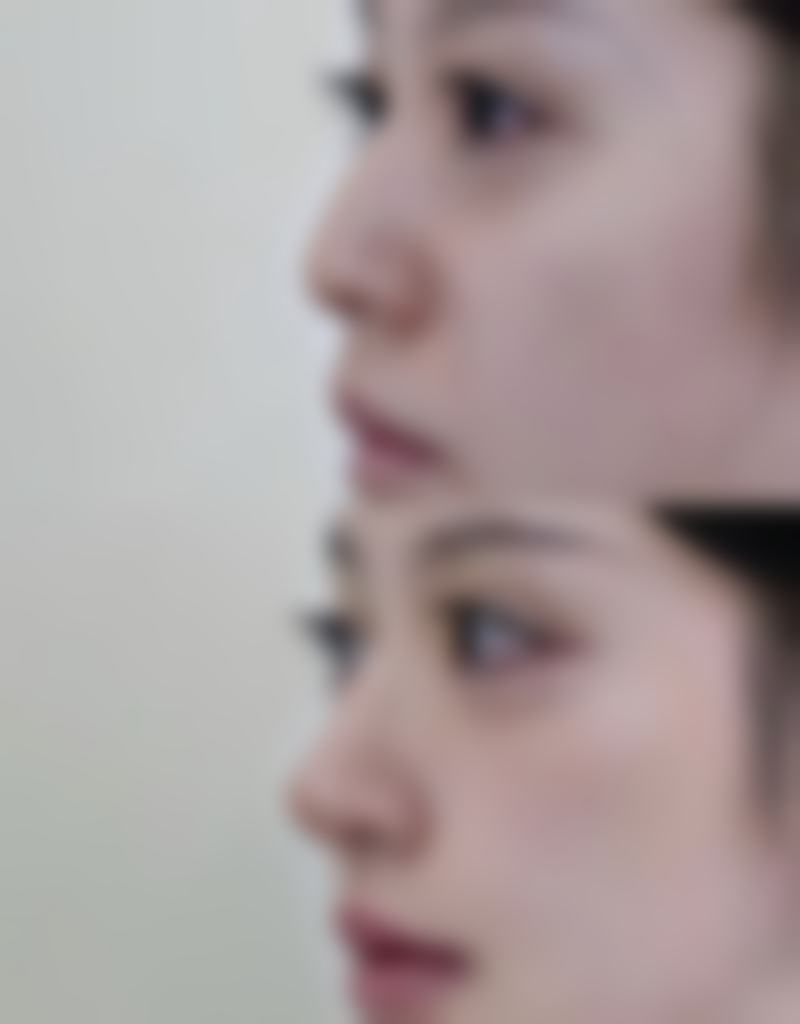 李广智医生的收费标准