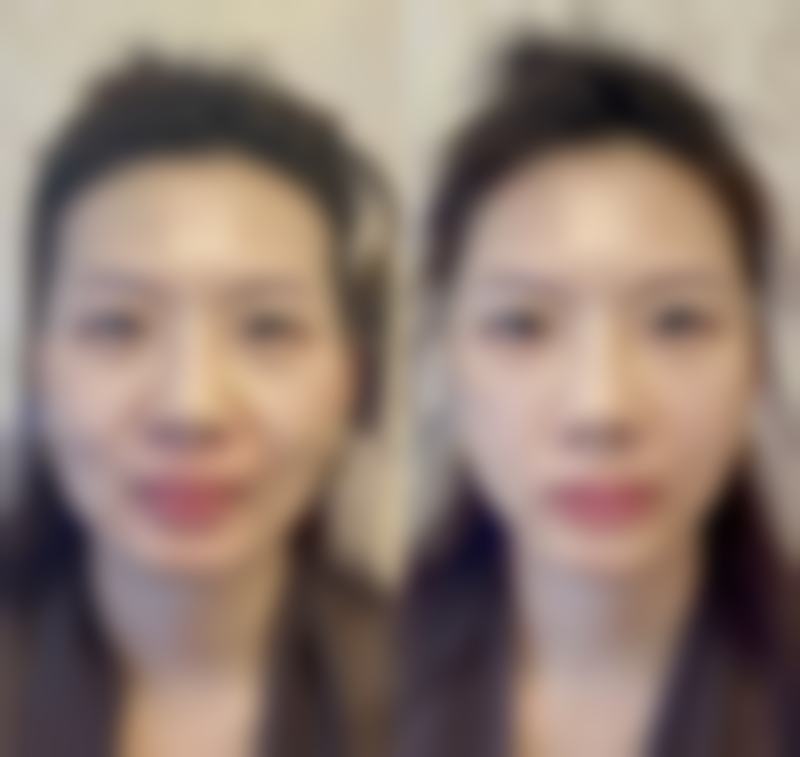 上海天坛普华整形来院路线怎么样