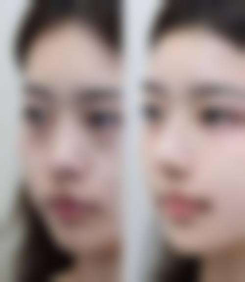 长春华瑷整形美容医院怎么样求美者反馈