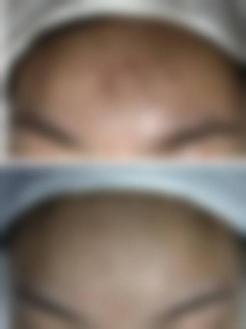 榆林誉美婕熹卡整形医院价格收费