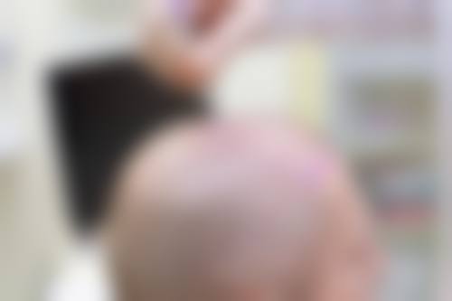 北京雍禾植发门诊部特色项目及技术优势