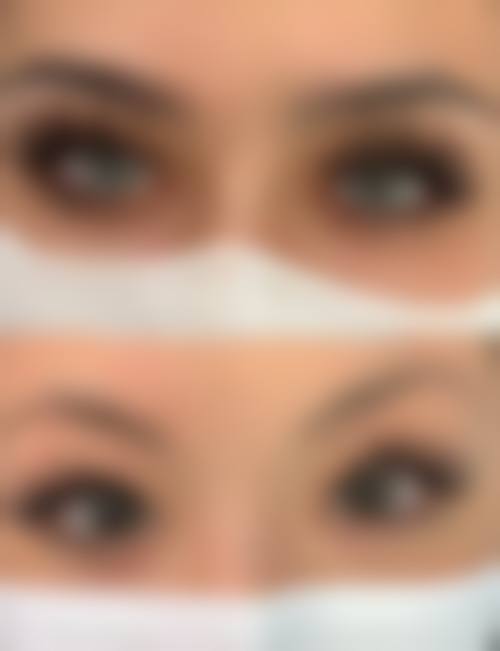 北京雍禾植发门诊部价格收费