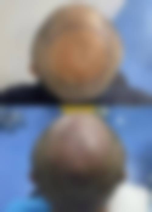 郑州华 山整形医院怎么样来院路线