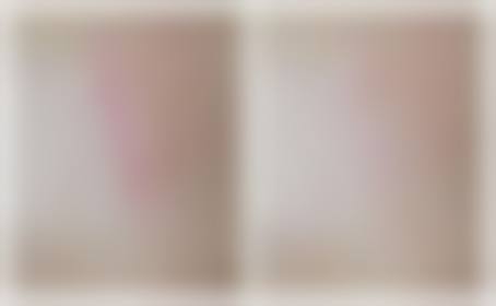 郑州华 山整形医院怎么样特色项目及技术优势