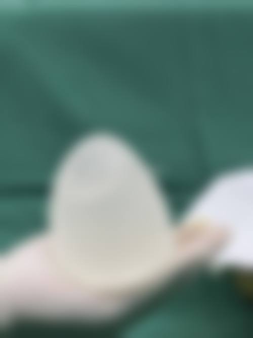 陈春松医生的擅长领域