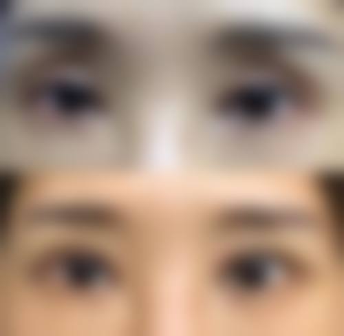 长春华瑷整形美容医院怎么样特色项目及技术优势