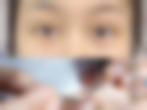 黄冈市中 心医院整形美容科求美者反馈