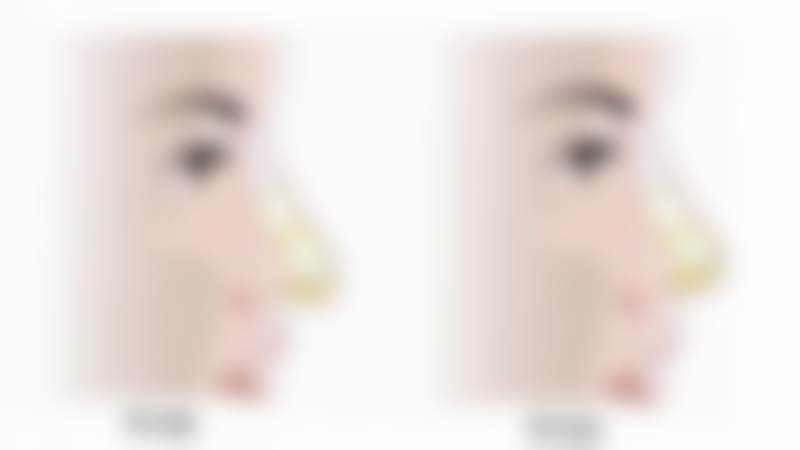 刘仁成医生的技术特色