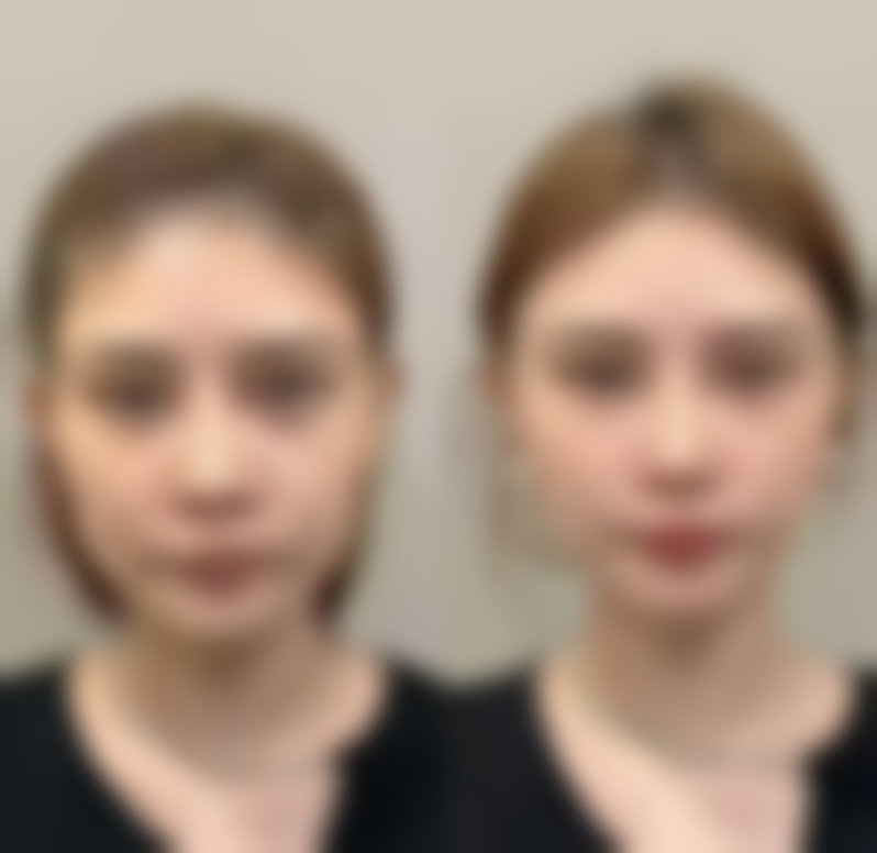 宁波鄞州美人颂整形医院怎么样来院路线