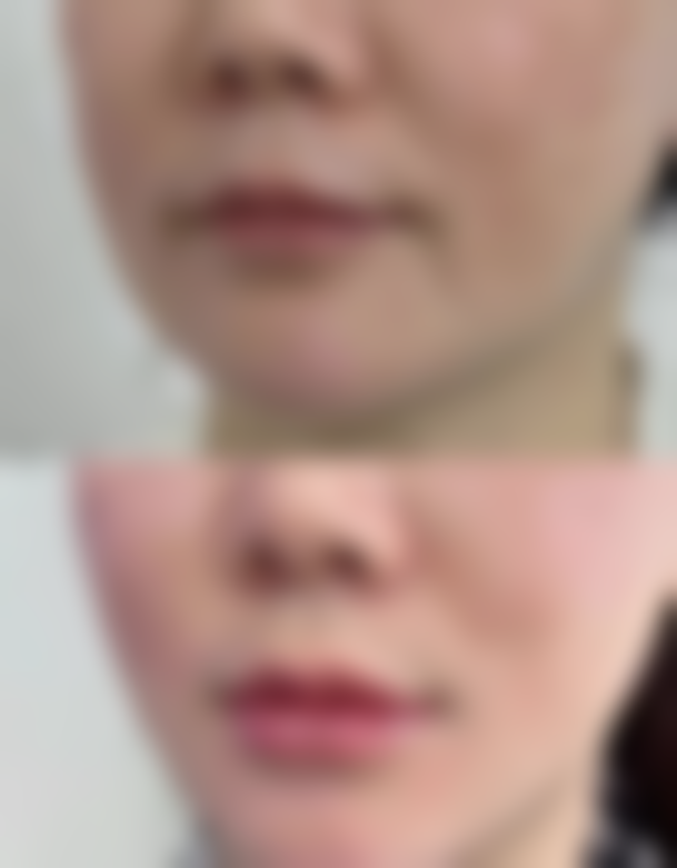 达州甄美医疗美容诊所价格收费