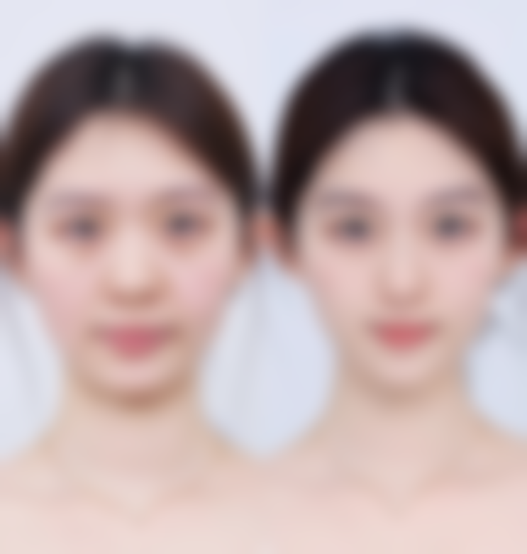 榆林誉美婕熹卡整形医院求美者反馈