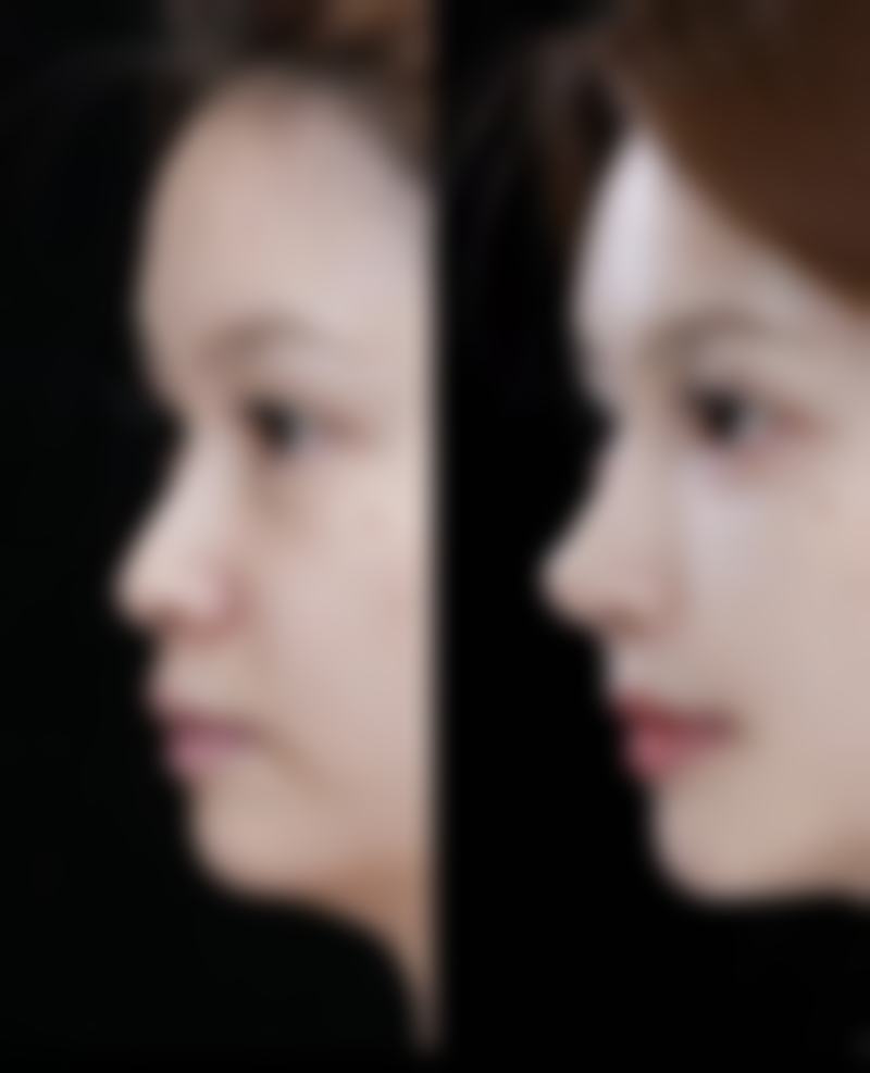 重庆圣熙整形医院求美者反馈