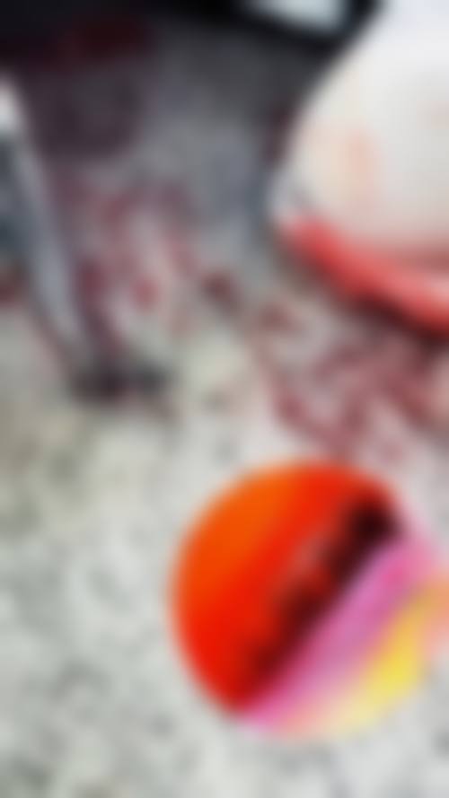 杭州大麦植发医院特色项目及技术优势