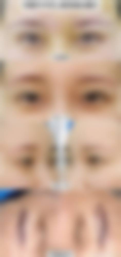 赖庆平医生的技术优势