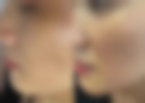 芜湖一秒整形医院价格收费