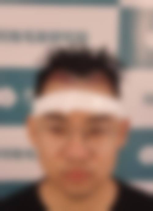 沈阳华美医院植发中 心怎么样医生团队实力