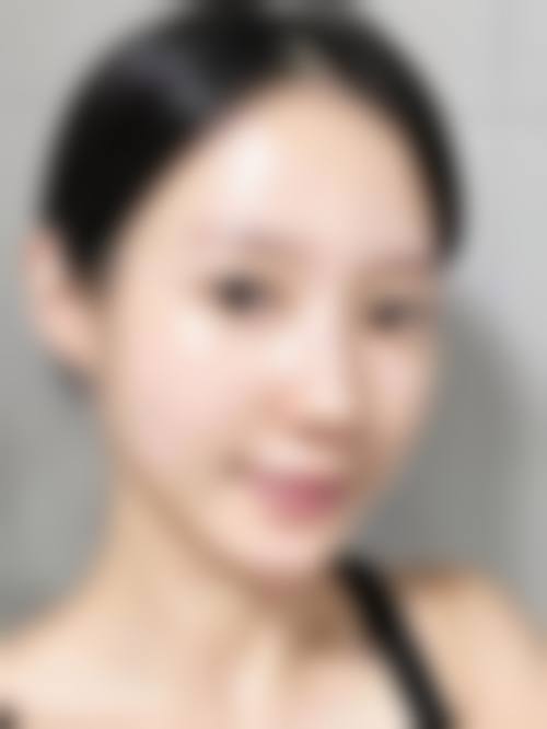 芜湖一秒整形医院求美者反馈