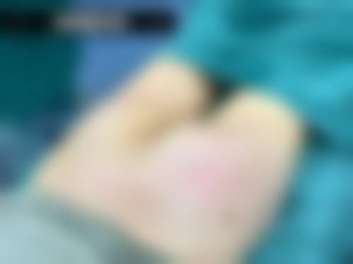 宋羽医生的项目价格