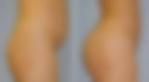 宋羽医生的技术特色