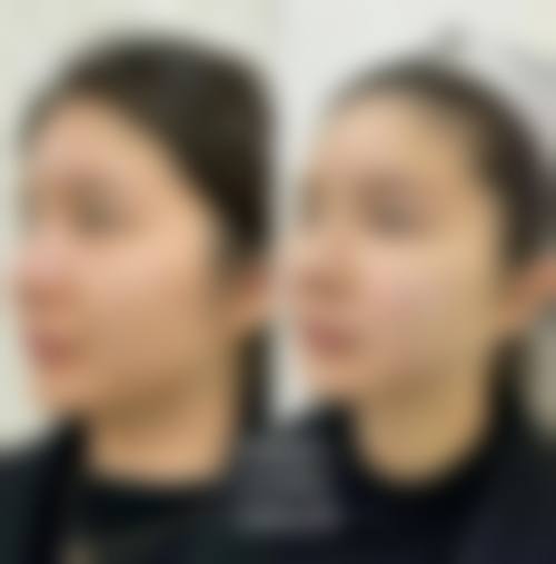 李钟喜医生的价格与服务