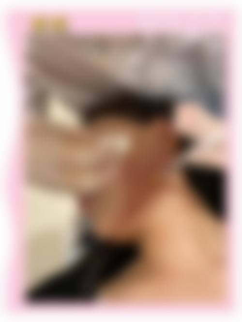 天津樱柏妍整形医院怎么样求美者反馈