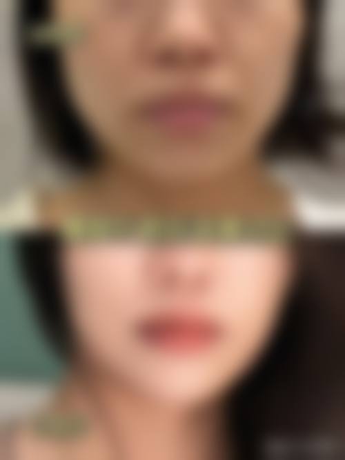 北京星宜整形医院求美者反馈