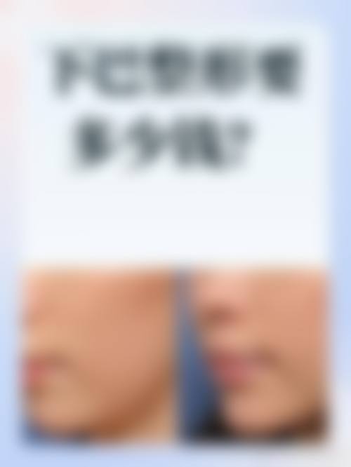 李钟喜医生值得信赖