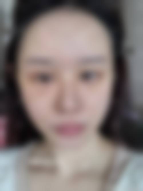 瑞安市人民医院医疗美容中 心求美者反馈