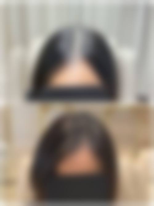 武汉大麦微针植发基本信息