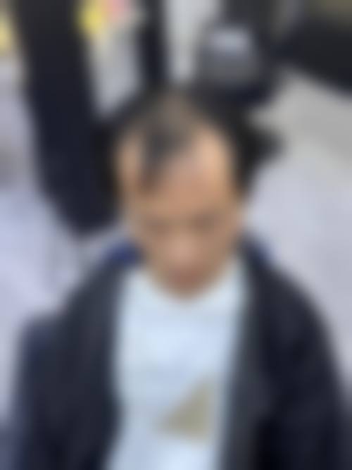 武汉大麦微针植发医院简介